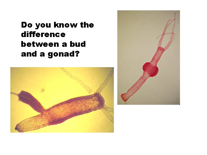 Do you know the difference between a bud and a gonad? 