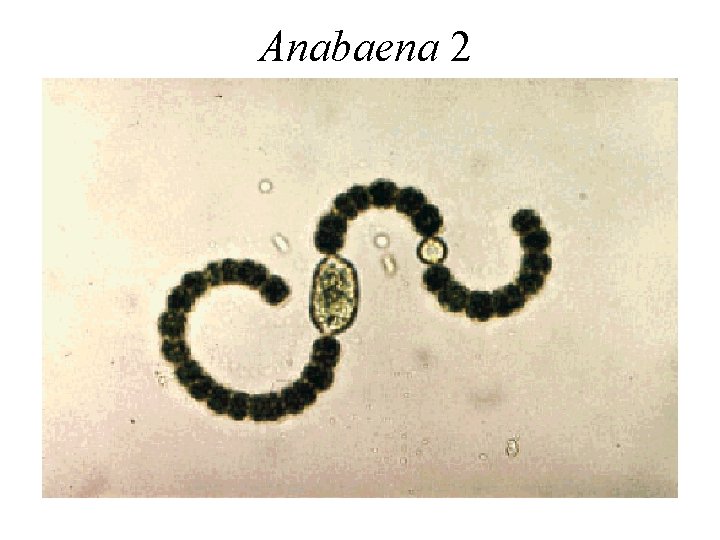 Anabaena 2 