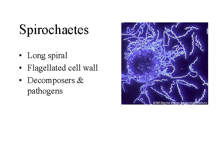 Spirochaetes • Long spiral • Flagellated cell wall • Decomposers & pathogens 