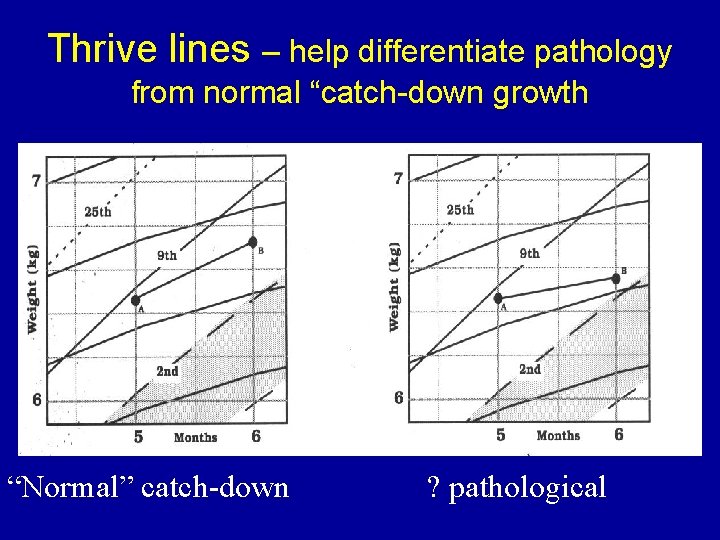 Thrive lines – help differentiate pathology from normal “catch-down growth “Normal” catch-down ? pathological