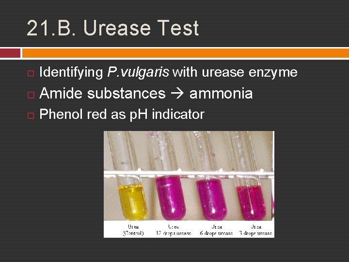 21. B. Urease Test Identifying P. vulgaris with urease enzyme Amide substances ammonia Phenol