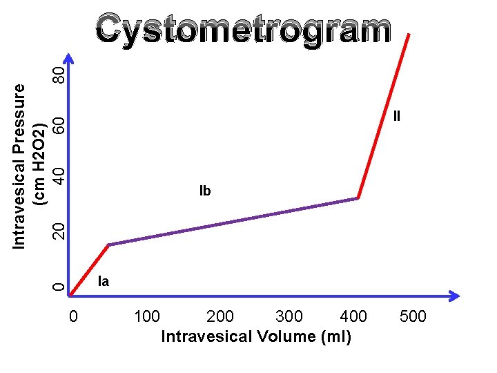 Intravesical Pressure (cm H 2 O 2) 20 40 60 80 Cystometrogram II Ib