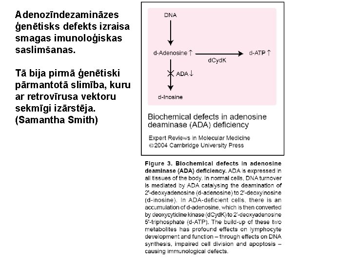 Adenozīndezamināzes ģenētisks defekts izraisa smagas imunoloģiskas saslimšanas. Tā bija pirmā ģenētiski pārmantotā slimība, kuru