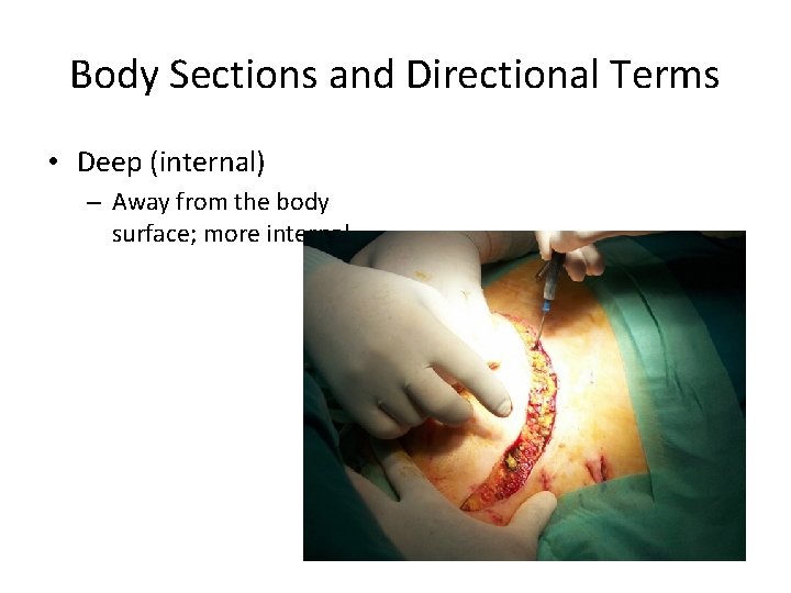 Body Sections and Directional Terms • Deep (internal) – Away from the body surface; Body Sections and Directional Terms • Deep (internal) – Away from the body surface;