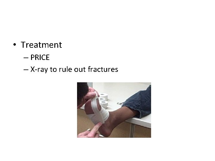  • Treatment – PRICE – X-ray to rule out fractures 