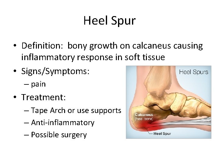 Heel Spur • Definition: bony growth on calcaneus causing inflammatory response in soft tissue Heel Spur • Definition: bony growth on calcaneus causing inflammatory response in soft tissue