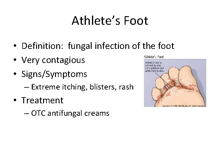 Athlete’s Foot • Definition: fungal infection of the foot • Very contagious • Signs/Symptoms