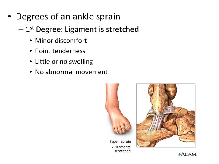 • Degrees of an ankle sprain – 1 st Degree: Ligament is stretched • Degrees of an ankle sprain – 1 st Degree: Ligament is stretched