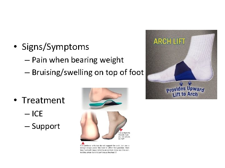 • Signs/Symptoms – Pain when bearing weight – Bruising/swelling on top of foot • Signs/Symptoms – Pain when bearing weight – Bruising/swelling on top of foot
