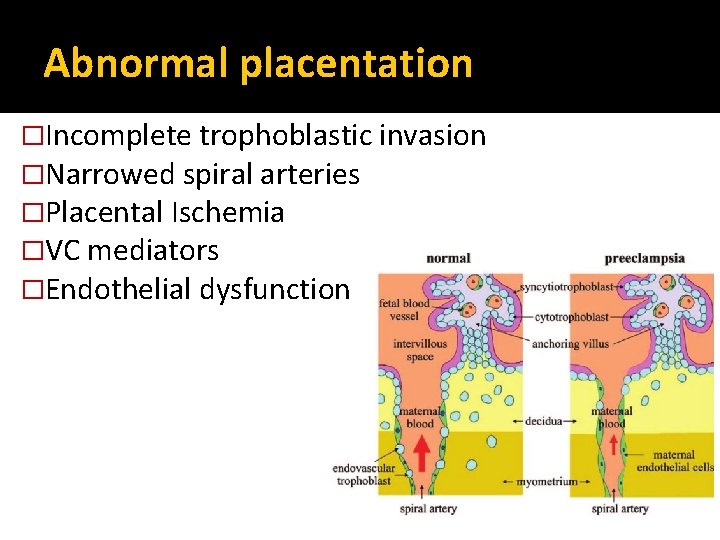 Abnormal placentation �Incomplete trophoblastic invasion �Narrowed spiral arteries �Placental Ischemia �VC mediators �Endothelial dysfunction