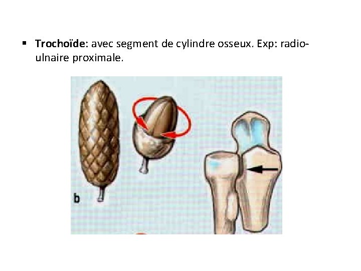 § Trochoïde: avec segment de cylindre osseux. Exp: radioulnaire proximale. 