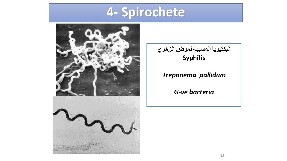 4 - Spirochete ﺍﻟﺒﻜﺘﻴﺮﻳﺎ ﺍﻟﻤﺴﺒﺒﺔ ﻟﻤﺮﺽ ﺍﻟﺰﻫﺮﻱ Syphilis Treponema pallidum G-ve bacteria 18 