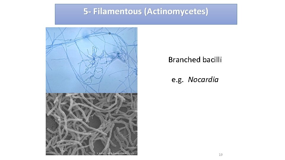 5 - Filamentous (Actinomycetes) Branched bacilli e. g. Nocardia 19 