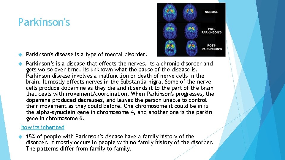 Parkinson's disease is a type of mental disorder. Parkinson’s is a disease that effects