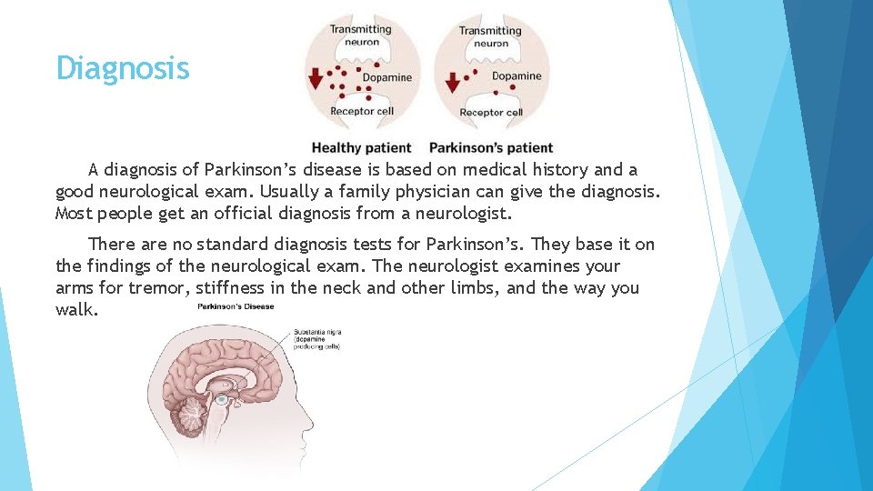 Diagnosis A diagnosis of Parkinson’s disease is based on medical history and a good