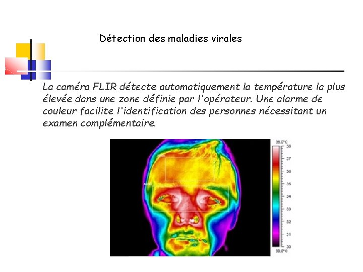 Détection des maladies virales La caméra FLIR détecte automatiquement la température la plus élevée
