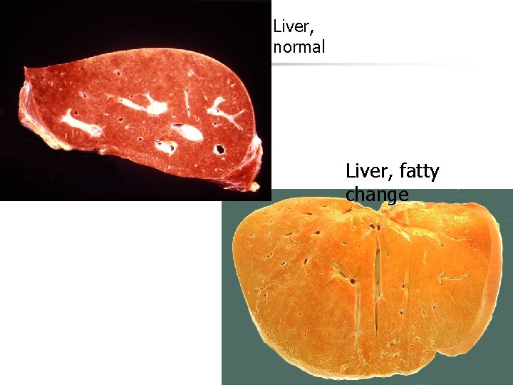 Liver, normal Liver, fatty change 