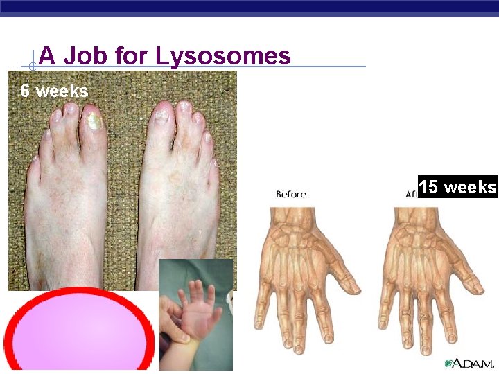 A Job for Lysosomes 6 weeks 15 weeks Regents Biology 