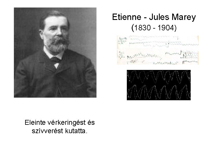 Etienne - Jules Marey (1830 - 1904) Eleinte vérkeringést és szívverést kutatta. 