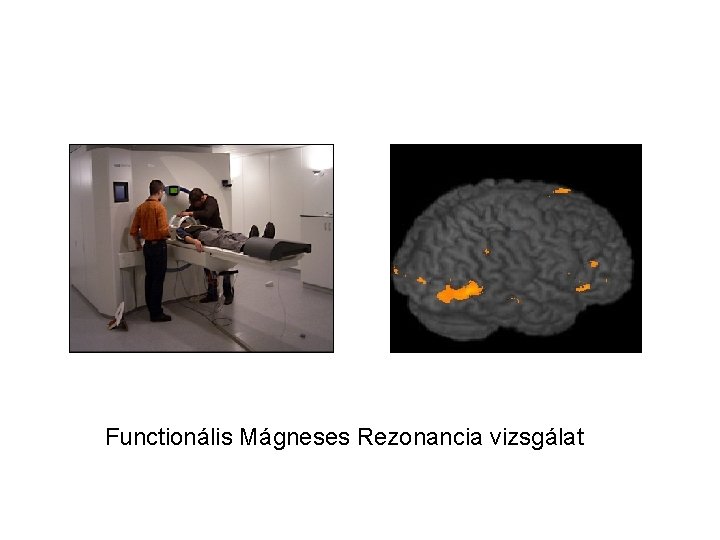 Functionális Mágneses Rezonancia vizsgálat 