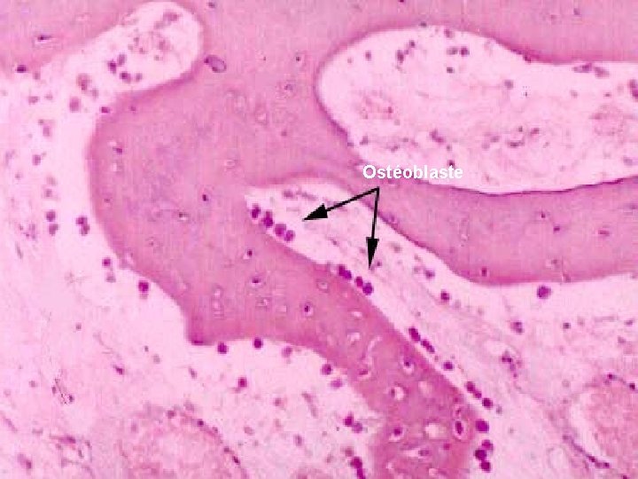 Ostéoblaste 