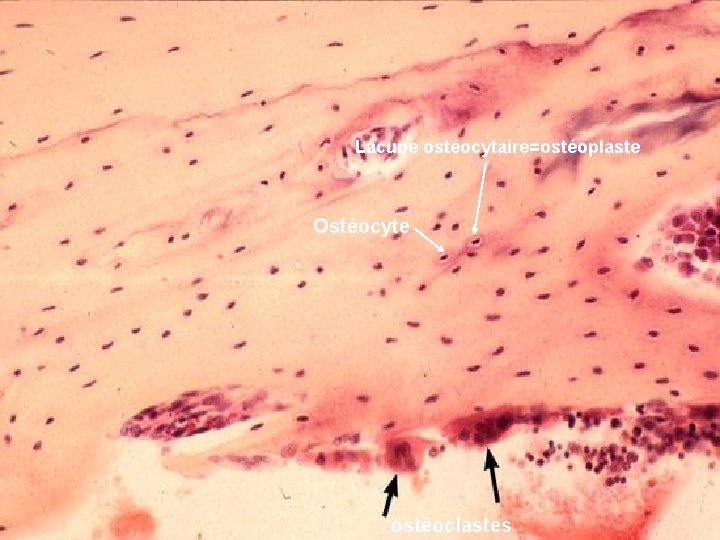 Lacune ostéocytaire=ostéoplaste Ostéocyte ostéoclastes 