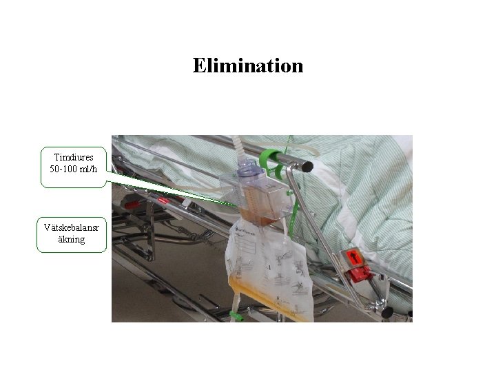 Elimination Timdiures 50 -100 ml/h Vätskebalansr äkning 