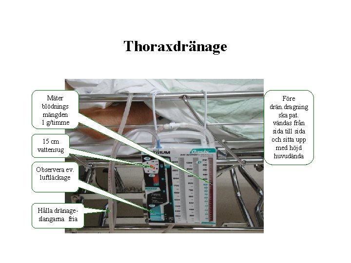 Thoraxdränage Mäter blödnings mängden 1 g/timme 15 cm vattensug Observera ev. luftläckage Hålla dränageslangarna