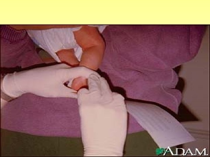 PKU TEST 