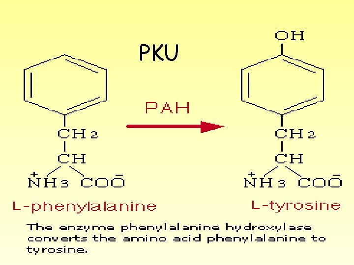 PKU 