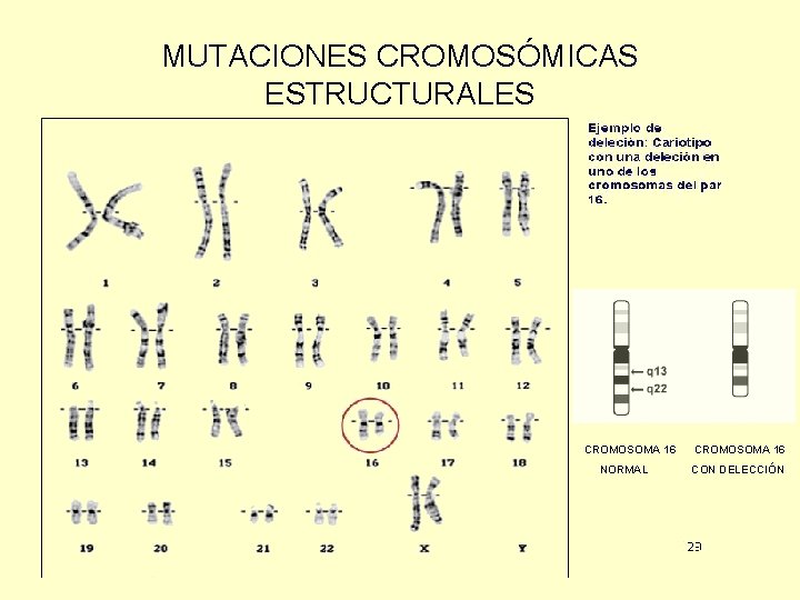 MUTACIONES CROMOSÓMICAS ESTRUCTURALES CROMOSOMA 16 NORMAL CROMOSOMA 16 CON DELECCIÓN 