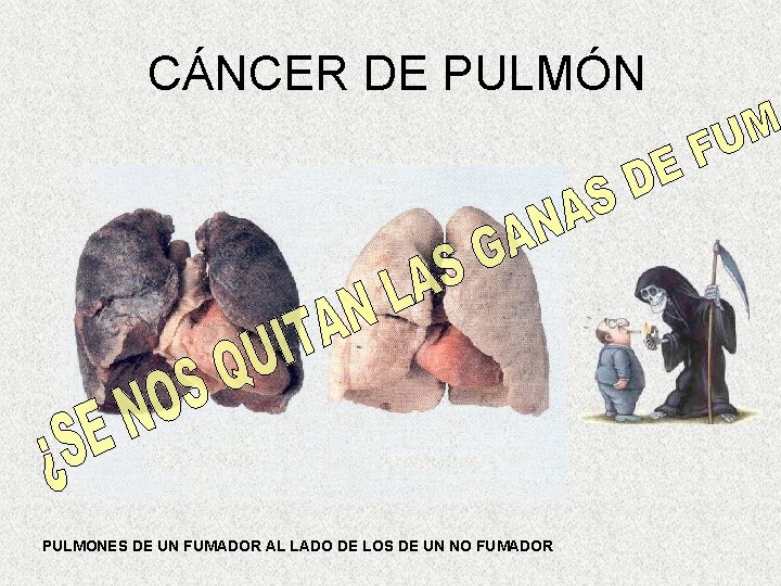 CÁNCER DE PULMÓN PULMONES DE UN FUMADOR AL LADO DE LOS DE UN NO