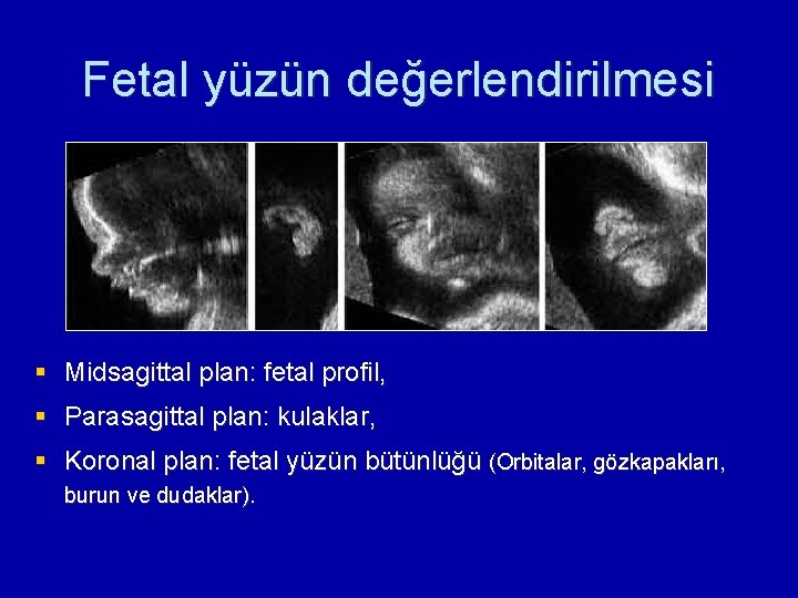 Fetal yüzün değerlendirilmesi § Midsagittal plan: fetal profil, § Parasagittal plan: kulaklar, § Koronal