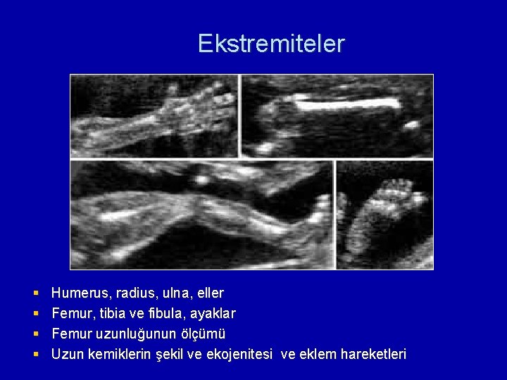 Ekstremiteler § § Humerus, radius, ulna, eller Femur, tibia ve fibula, ayaklar Femur uzunluğunun