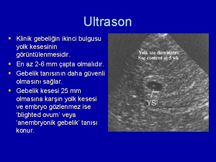 Ultrason § Klinik gebeliğin ikinci bulgusu yolk kesesinin görüntülenmesidir. § En az 2 -6
