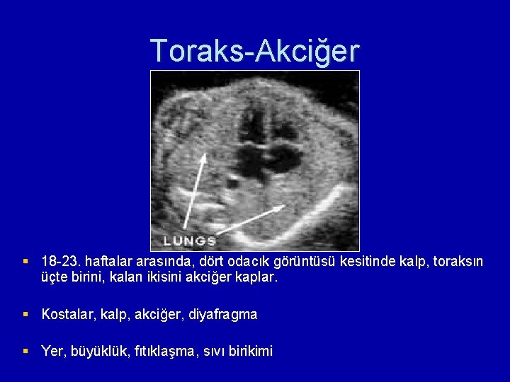 Toraks-Akciğer § 18 -23. haftalar arasında, dört odacık görüntüsü kesitinde kalp, toraksın üçte birini,