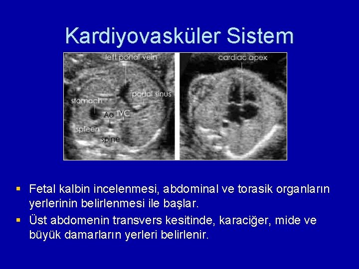 Kardiyovasküler Sistem § Fetal kalbin incelenmesi, abdominal ve torasik organların yerlerinin belirlenmesi ile başlar.