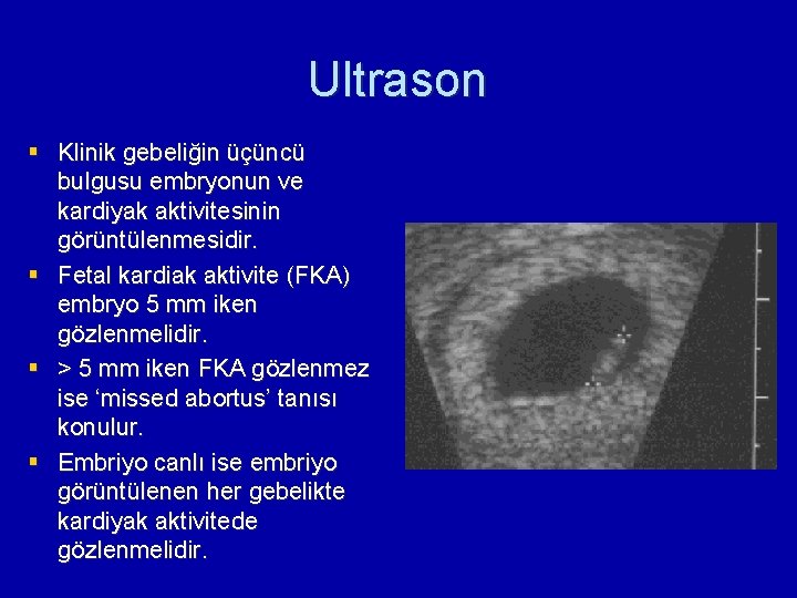 Ultrason § Klinik gebeliğin üçüncü bulgusu embryonun ve kardiyak aktivitesinin görüntülenmesidir. § Fetal kardiak