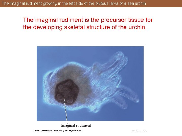 The imaginal rudiment growing in the left side of the pluteus larva of a