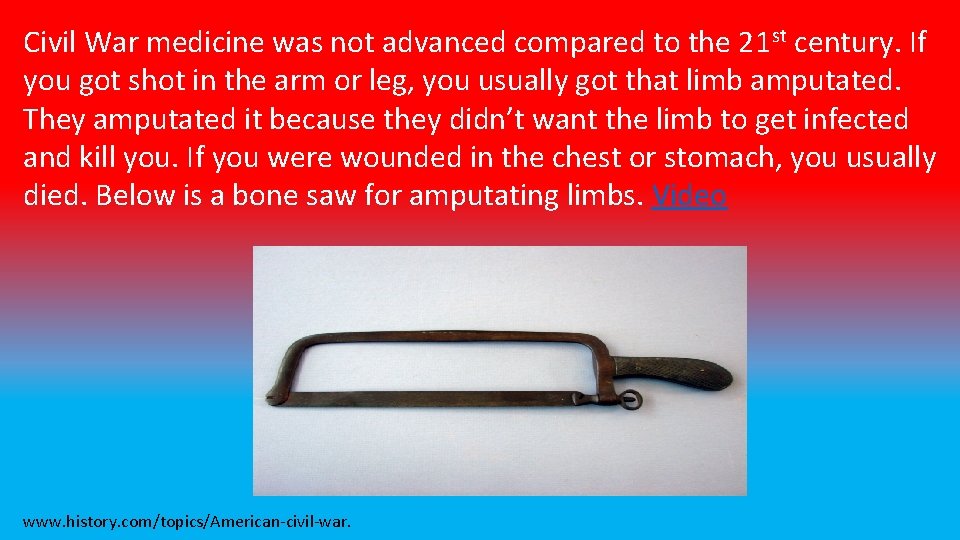 Civil War medicine was not advanced compared to the 21 st century. If you