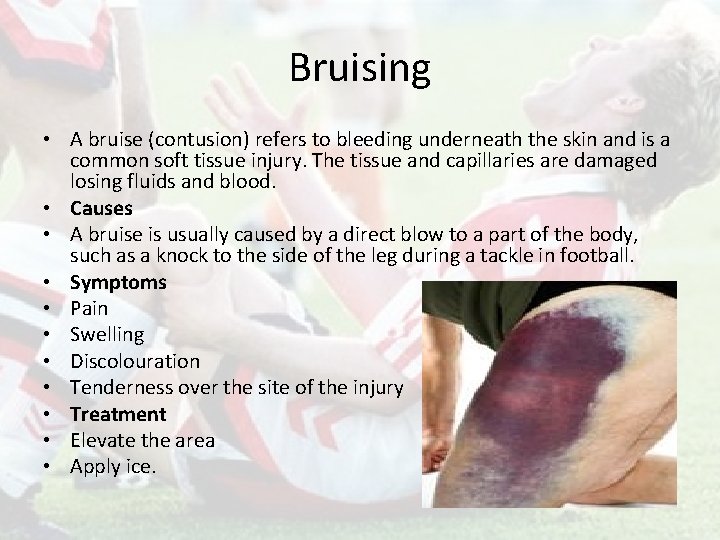 Bruising • A bruise (contusion) refers to bleeding underneath the skin and is a