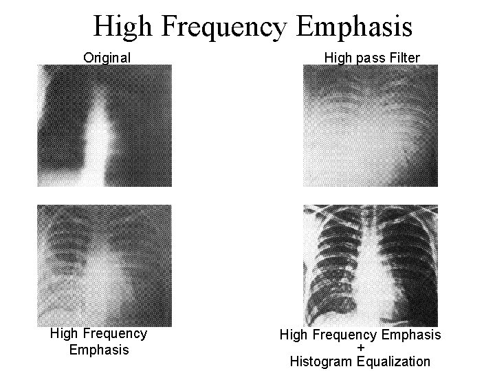 High Frequency Emphasis Original High Frequency Emphasis High pass Filter High Frequency Emphasis +