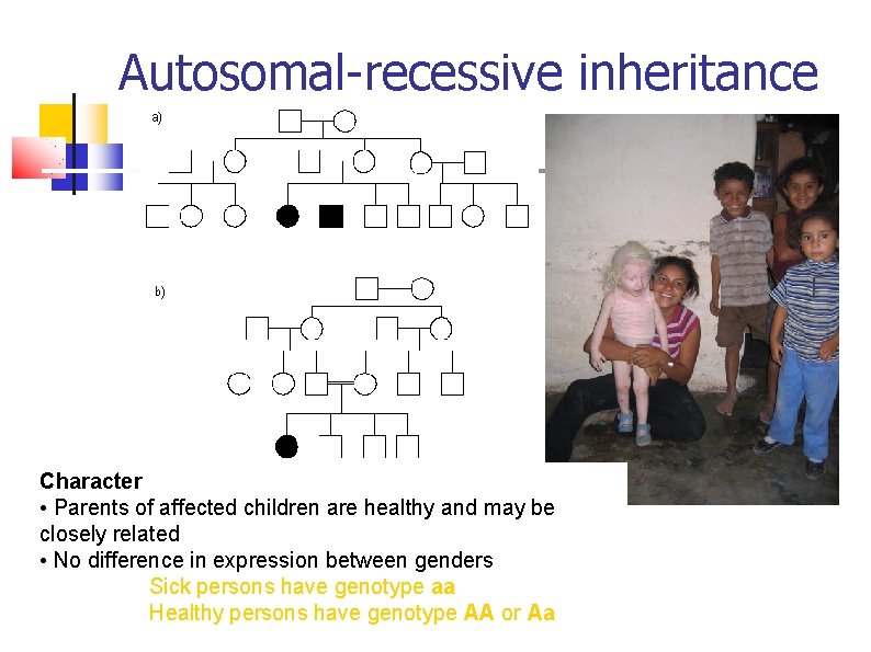 Autosomal-recessive inheritance Character • Parents of affected children are healthy and may be closely