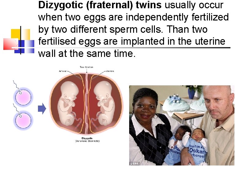 Dizygotic (fraternal) twins usually occur when two eggs are independently fertilized by two different