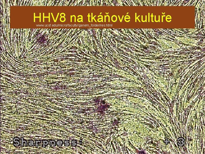 HHV 8 na tkáňové kultuře www. ucsf. edu/micro/faculty/ganem_folder/res. html 