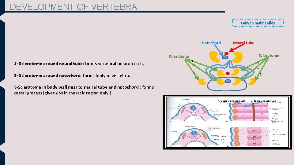 DEVELOPMENT OF VERTEBRA Only in male’s slide Notochord Neural tube Sclerotome 1 - Sclerotome