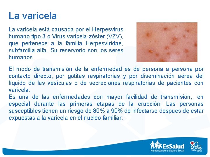 La varicela está causada por el Herpesvirus humano tipo 3 o Virus varicela-zóster (VZV),