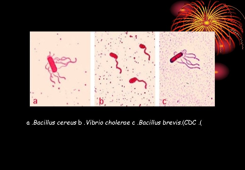 a. Bacillus cereus b. Vibrio cholerae c. Bacillus brevis. (CDC. ( 