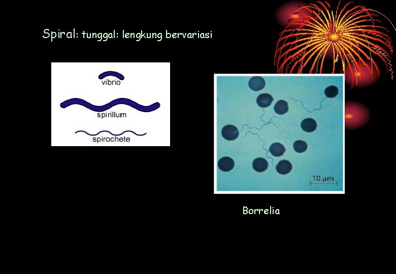 Spiral: tunggal: lengkung bervariasi Borrelia 
