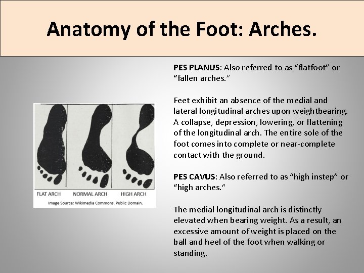 Anatomy of the Foot: Arches. PES PLANUS: Also referred to as “flatfoot” or “fallen